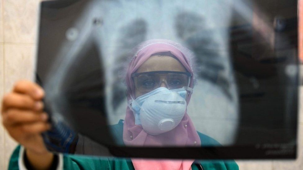 COVID-19 in Egypt: 279 new cases, 9 deaths on Tuesday