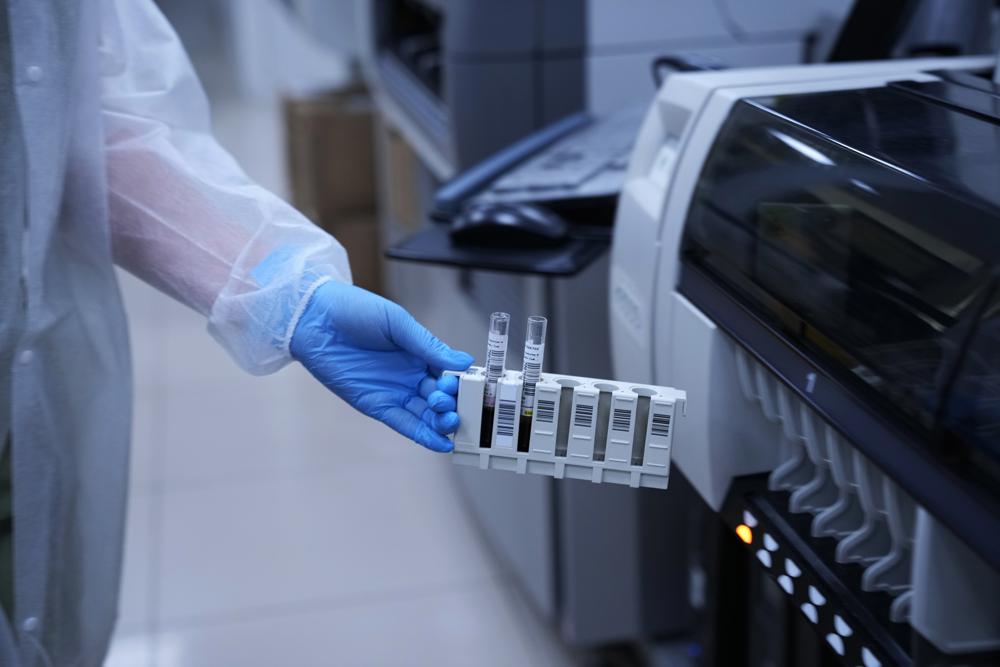 Antibody tests for COVID-19 remain popular in Russia