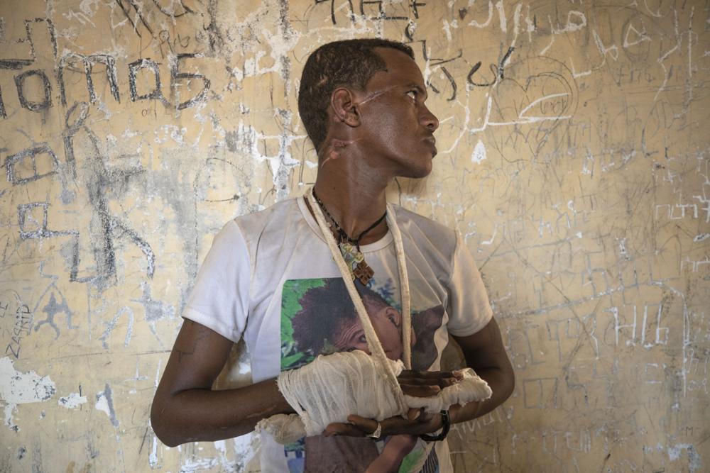 UN report says Ethiopia’s war marked by ‘extreme brutality’