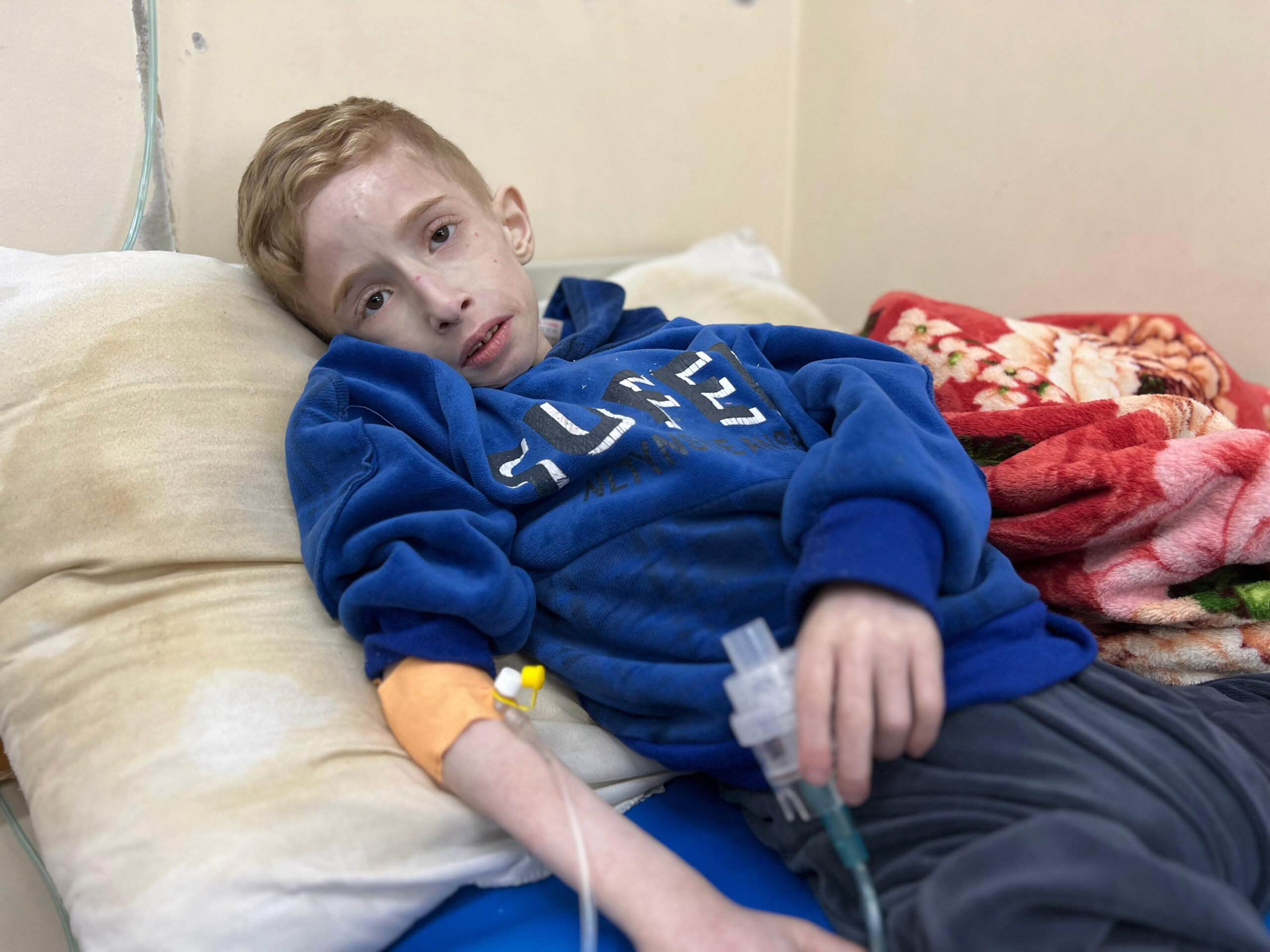 Relative of Palestinian boy facing starvation in northern Gaza says “there is no treatment” for him