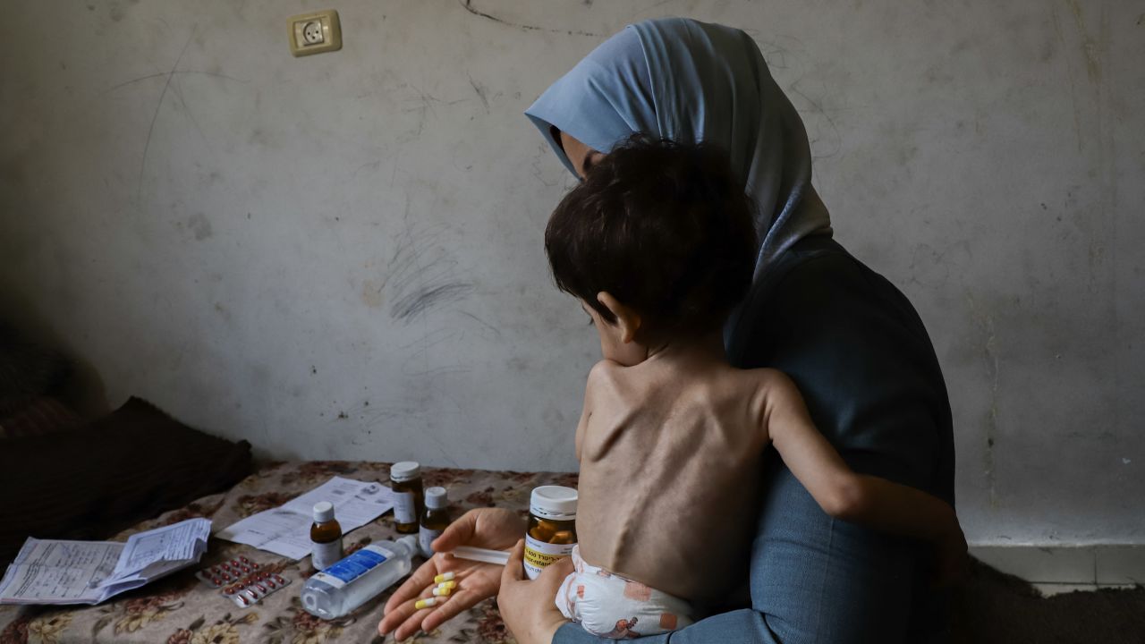Children are dying of starvation in their parents’ arms as famine spreads through Gaza